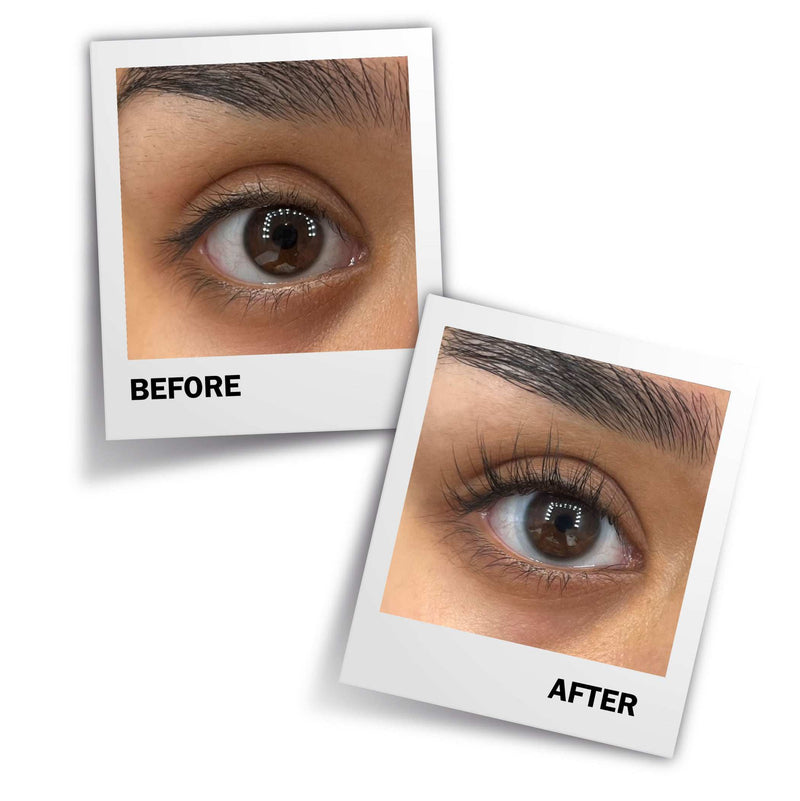 flash-before-after-variation - fLASH Cosmetics