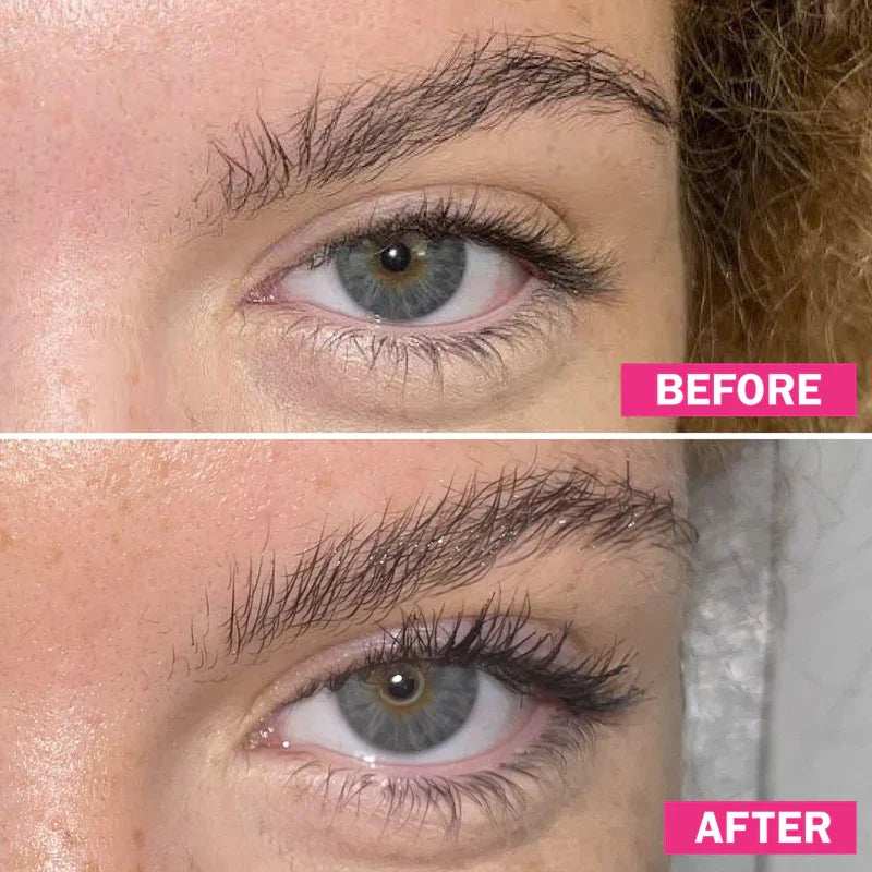 fLASH Eyelash Serum Results Before After Image 9