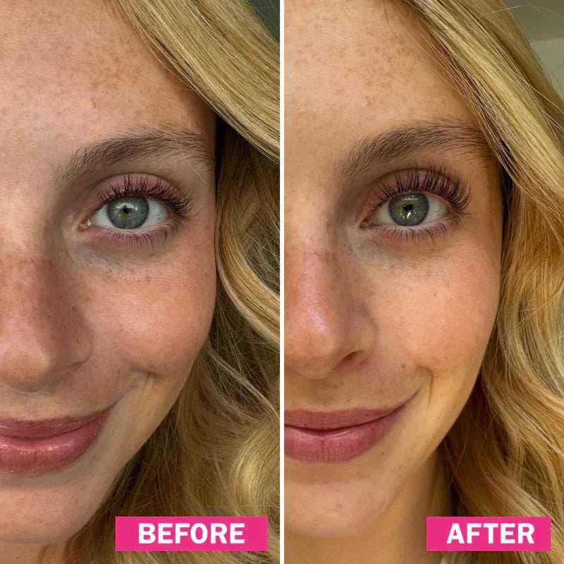 fLASH Eyelash Serum Results Before After Image 5